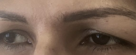 Eyebrow-Client-2-Before-