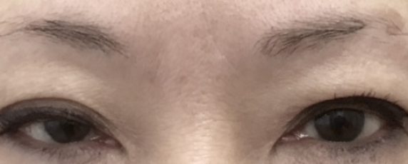 Eyebrow-Client-3-Before-